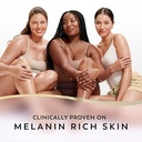 OLAY DARK SPOT CORRECTING (AHA & VITAMIN C+NIACINAMIDE) BODY LOTION 502ML